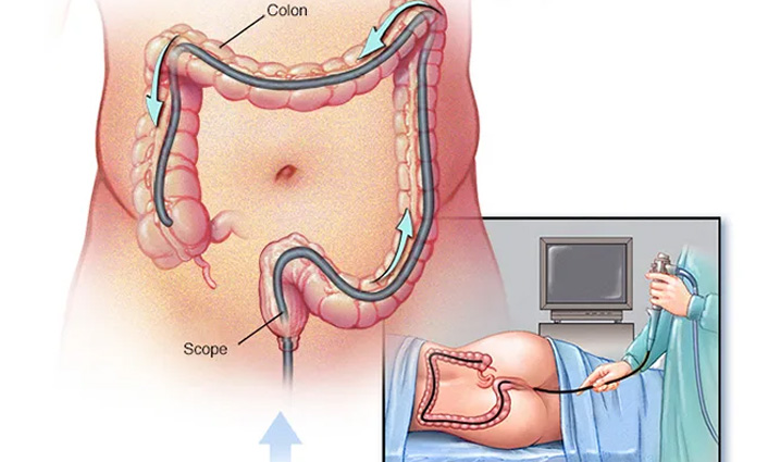 Basti Therapy in Thane