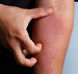 Skin Diseases Treatment in Thane